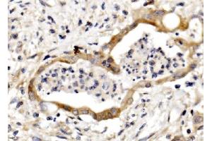 IHC analysis of Nectin 3/NECTIN3 using anti-Nectin 3/NECTIN3 antibody (ABIN7602666).