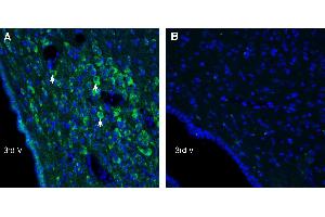 anti-Uncoupling Protein 2 (Mitochondrial, Proton Carrier) (UCP2) (AA 153-164), (Intracellular) antibody