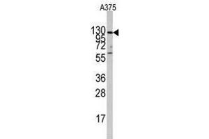 Image no. 2 for anti-Insulin-Degrading Enzyme (IDE) (Center) antibody (ABIN356957) (IDE Antikörper  (Center))