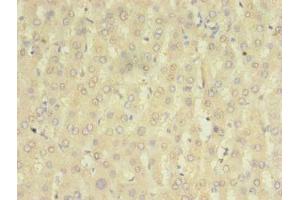 Immunohistochemistry of paraffin-embedded human liver tissue using ABIN7155881 at dilution of 1:100 (HOMER2 Antikörper  (AA 1-343))