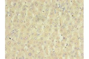 Immunohistochemistry of paraffin-embedded human liver tissue using ABIN7155881 at dilution of 1:100