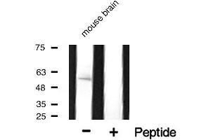 Western blot analysis of Cytochrome P450 17A1 expression in mouse tissue. (CYP17A1 Antikörper  (Internal Region))