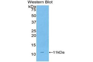Western blot analysis of the recombinant protein. (CD3D Antikörper  (AA 22-106))