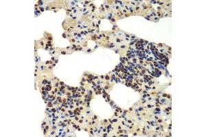 Immunohistochemistry (Paraffin-embedded Sections) (IHC (p)) image for anti-DEAD (Asp-Glu-Ala-Asp) Box Polypeptide 5 (DDX5) (AA 1-614) antibody (ABIN6139505)