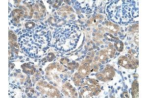 SLC38A4 antibody was used for immunohistochemistry at a concentration of 4-8 ug/ml to stain Epithelial cells of renal tubule (arrows) in Human Kidney.
