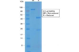 SDS-PAGE Analysis Purified Rabbit Recombinant Monoclonal Antibody (VWF/1859R).