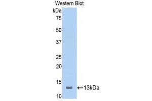 Western Blotting (WB) image for anti-Inducible T-Cell Co-Stimulator (ICOS) (AA 39-133) antibody (ABIN3207896) (ICOS Antikörper  (AA 39-133))