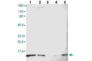 Western blot analysis of Lane 1: RT-4, Lane 2: U-251 MG, Lane 3: Human Plasma, Lane 4: Liver, Lane 5: Tonsil with DYNLT3 polyclonal antibody . (DYNLT3 Antikörper)