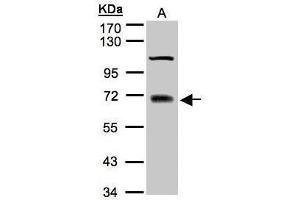 WB Image Sample(30 μg of whole cell lysate) A:A431 7. (TRIM25 Antikörper)