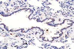 Immunohistochemistry (Paraffin-embedded Sections) (IHC (p)) image for anti-Proteasome (Prosome, Macropain) 26S Subunit, Non-ATPase, 8 (PSMD8) antibody (ABIN7075226)