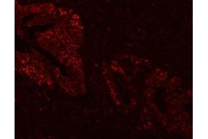 IF analysis of FEN1 using anti-FEN1 antibody (ABIN7601617). (FEN1 Antikörper  (AA 4-300))