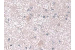 Immunohistochemistry (IHC) image for anti-ADAM Metallopeptidase with Thrombospondin Type 1 Motif, 10 (ADAMTS10) (AA 239-602) antibody (ABIN7443695)