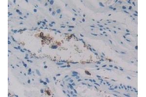 Immunohistochemistry (IHC) image for anti-Regenerating Islet Derived Protein 3 gamma (REG3g) (AA 39-175) antibody (ABIN7435838)