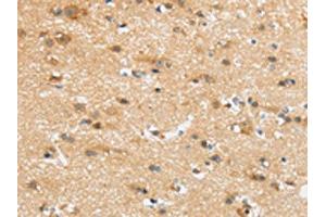 The image on the left is immunohistochemistry of paraffin-embedded Human brain tissue using ABIN7192978(UBTD2 Antibody) at dilution 1/35, on the right is treated with synthetic peptide.