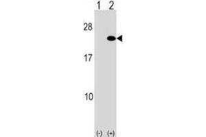 Western Blotting (WB) image for anti-ADP-Ribosylation Factor 5 (ARF5) antibody (ABIN2999205) (ARF5 Antikörper)