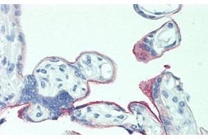 Detection of 0 in Human Placenta Tissue using Polyclonal Antibody to 5T4 (TPBG Antikörper  (AA 32-351))