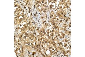 Immunohistochemistry (IHC) image for anti-Ribosomal Protein S6 (RPS6) (AA 1-100) antibody (ABIN6147227)
