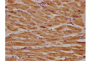 IHC image of ABIN7154398 diluted at 1:300 and staining in paraffin-embedded human heart tissue performed on a Leica BondTM system. (CSF3R Antikörper  (AA 117-337))