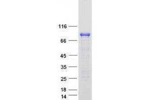 Western Blotting (WB) image for Forkhead Box O3 (FOXO3) (Transcript Variant 2) protein (Myc-DYKDDDDK Tag) (ABIN2721367)