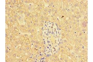 Immunohistochemistry of paraffin-embedded human liver tissue using ABIN7147018 at dilution of 1:100 (Cathepsin L Antikörper  (AA 114-288))