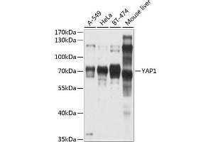 Western blot analysis of extracts of various cell lines, using Y antibody (ABIN6132788, ABIN6150316, ABIN6150321 and ABIN6215135) at 1:1000 dilution. (YAP1 Antikörper  (AA 155-504))
