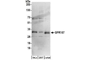 Western Blotting (WB) image for anti-G Protein-Coupled Receptor 157 (GPR175) (AA 285-335) antibody (ABIN7450300)