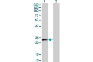 Western Blot analysis of FBXO36 expression in transfected 293T cell line by FBXO36 monoclonal antibody (M02), clone 3D3. (FBXO36 Antikörper  (AA 66-165))