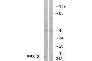 Western blot analysis of extracts from COLO cells, using RPS12 antibody. (RPS12 Antikörper  (C-Term))