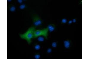 Anti-EPHX2 mouse monoclonal antibody (ABIN2452991) immunofluorescent staining of COS7 cells transiently transfected by pCMV6-ENTRY EPHX2 (RC202489). (EPHX2 Antikörper)