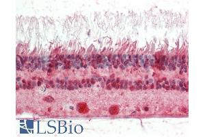 ABIN1590000 (5µg/ml) staining of paraffin embedded Human Retina. (CRX Antikörper  (Internal Region))