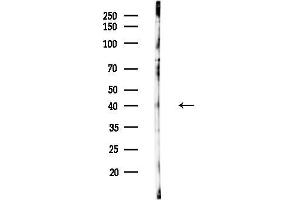 anti-ELOVL Fatty Acid Elongase 4 (ELOVL4) (Internal Region) antibody
