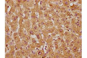 Immunohistochemistry of paraffin-embedded human liver tissue using ABIN7171480 at dilution of 1:100 (WRB Antikörper  (AA 38-99))
