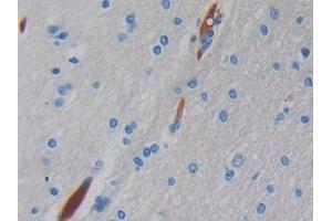 DAB staining on IHC-P; Samples: Human Brain Tissue (Hemoglobin, mu Antikörper  (AA 13-141))