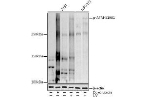 Western blot analysis of extracts of various cell lines, using (ABIN3019428, ABIN3019429, ABIN3019430 and ABIN6225361) at 1:1000 dilution. (ATM Antikörper  (pSer1981))