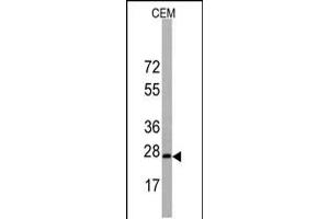 Western blot analysis of BarX1 Antibody in CEM cell line lysates (35ug/lane).