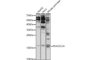 Western blot analysis of extracts of various cell lines, using PLG12A antibody (ABIN7269339) at 1:1000 dilution.