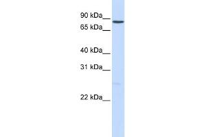 WB Suggested Anti-NOTCH1 Antibody Titration:  0. (Notch1 Antikörper  (Middle Region))