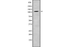 Western blot analysis of CLCN1 using K562 whole cell lysates