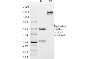 SDS-PAGE Analysis Purified N-Cadherin Mouse Monoclonal Antibody (CDH2/1573). (N-Cadherin Antikörper  (Intracellular))
