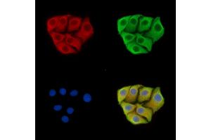 anti-TP53 Target 1 (Non-Protein Coding) (TP53TG1) antibody