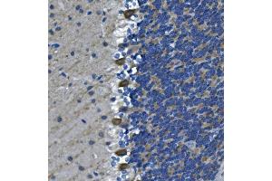 IHC analysis of DGKZ/DGK-zeta using anti-DGKZ/DGK-zeta antibody (ABIN7602261).