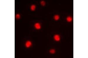 Immunofluorescent analysis of ZNF265 staining in HepG2 cells.