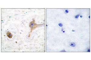 Immunohistochemistry (IHC) image for anti-GABA B Receptor (C-Term) antibody (ABIN1848554) (GABA B Receptor (C-Term) Antikörper)