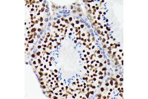 Immunohistochemistry of paraffin-embedded mouse testis using EWSR1 Rabbit mAb (ABIN7267053) at dilution of 1:100 (40x lens). (EWSR1 Antikörper)