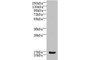 Western blot All lanes: ZNRD1 antibody at 14 μg/mL + Human high value serum Secondary Goat polyclonal to rabbit IgG at 1/10000 dilution Predicted band size: 14 kDa Observed band size: 14 kDa (ZNRD1 Antikörper  (AA 1-126))