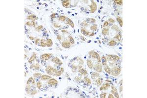 Immunohistochemistry of paraffin-embedded human stomach using ACP1 antibody (ABIN5975334) at dilution of 1/100 (40x lens). (ACP1 Antikörper)