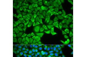 Immunofluorescence analysis of HeLa cells using SLC3A1 Polyclonal Antibody (SLC3A1 Antikörper)