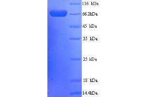 SDS-PAGE (SDS) image for Protein tyrosine Phosphatase, Receptor Type, N Polypeptide 2 (PTPRN2) (AA 22-615) protein (His tag) (ABIN5714444) (PTPRN2 Protein (AA 22-615) (His tag))