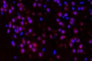 Immunofluorescent analysis of paraformaldehyde-fixed mouse brain substantia nigra using p38IP (ABIN7075954) at dilution of 1: 400 (Transcription Factor SPT20 Homolog (SUPT20H) Antikörper)