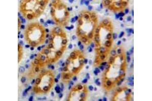 Used in DAB staining on fromalin fixed paraffin-embedded Kidney tissue (Peroxiredoxin 5 Antikörper  (AA 1-162))